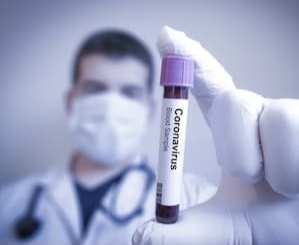 За минувшие сутки в Ростовской области не зарегистрировано случаев смерти среди больных COVID-19 За минувшие сутки в Ростовской области не зарегистрировано случаев смерти среди больных COVID-19